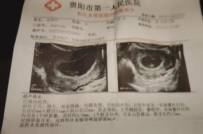 孕妇担忧：害怕美味成“隐患”PG电子麻将胡了火锅底料过期